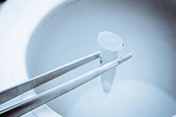Cryopreservation (Representational Picture) Cryopreservation