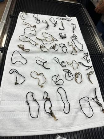 The 38 hair ties found in Juliet's stomach Hair ties