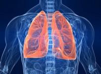 Researchers tests AI tool that predicts risk of lung cancer