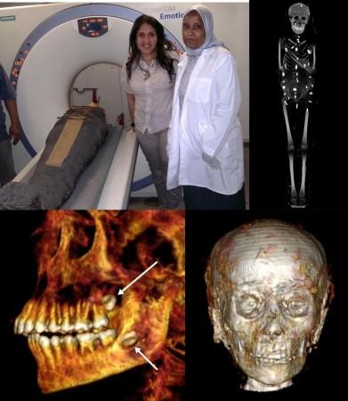 Egyptian researchers find golden amulets inside 2,300-year-old mummy through 'digital unwrapping'. Egyptian researchers find golden amulets inside 2,300-year-old mummy through 'digital unwrapping'.