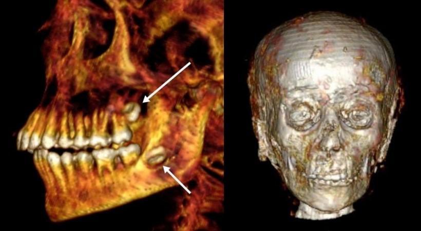 Egyptian researchers find golden amulets inside 2,300-year-old mummy through 'digital unwrapping' Egyptian researchers find golden amulets inside 2,300-year-old mummy through 'digital unwrapping'