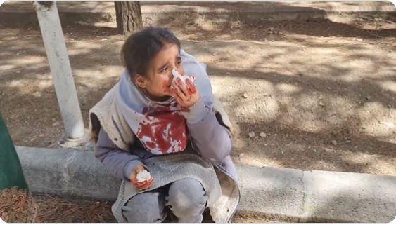 Mockery of women’s rights? Hit for not wearing hijab, this little Iranian girl cries inconsolably, bleeds profusely [Details]