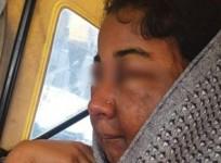 Bride-to-be goes to ICU after makeup; beautician detained in Karnataka.