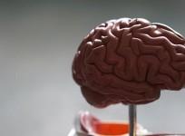 Alzheimer's disease
