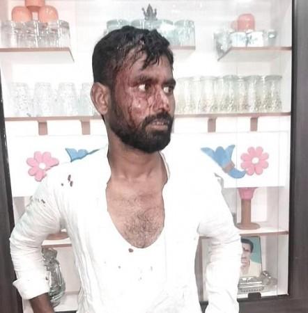 A fight broke out between BJP and Congress workers in Sanjeevarayanakote village of Ballari Rural Constituency. Bellary rural constituency