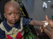 1st clinical trial of measles vaccine delivery via stickers shows promise