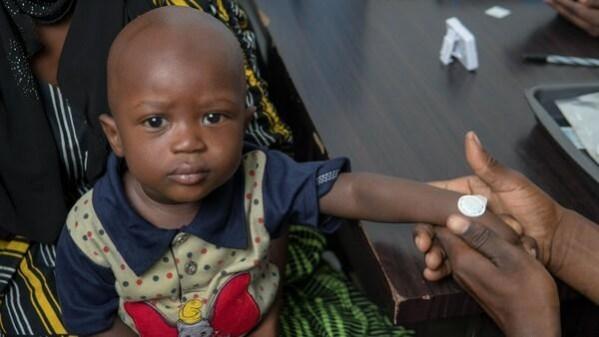 Congo has launched the second phase of vaccination against mpox. 1st clinical trial of measles vaccine delivery via stickers shows promise