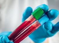 Blood tests