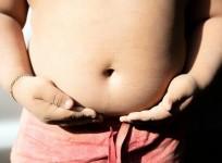 Obesity