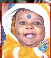 Five-month-old baby dies in attack by stray dogs in Hyderabad Five-month-old baby dies in attack by stray dogs in Hyderabad