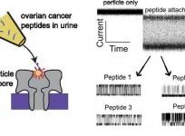 New Method May Detect Early Ovarian Cancer From Urine
