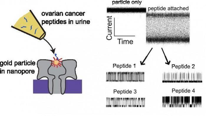 New Method May Detect Early Ovarian Cancer From Urine. New Method May Detect Early Ovarian Cancer From Urine