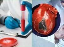 A Simple Blood Test To Predict Risk Of Heart Attack Within Six Months