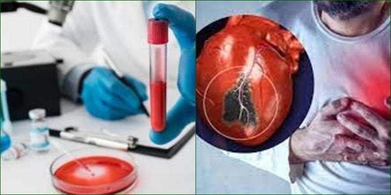 A Simple Blood Test To Predict Risk Of Heart Attack Within Six Months A Simple Blood Test To Predict Risk Of Heart Attack Within Six Months