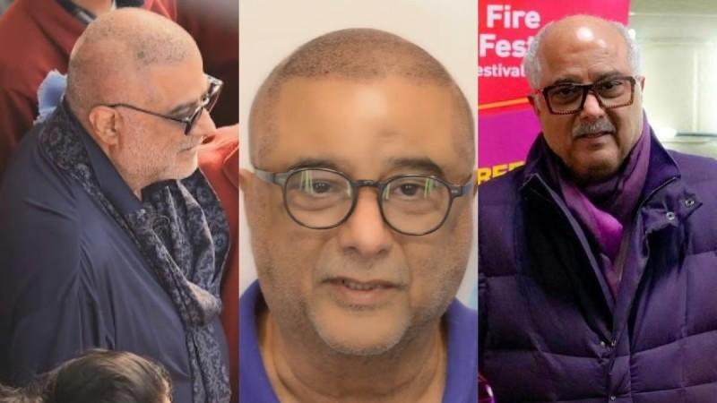 Boney Kapoor undergoes hair transplant; see before and after pics Boney Kapoor undergoes hair transplant; see before and after pics
