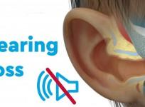 Hearing Loss: Early Screening, Diagnosis Is Key To Ensue 'Sound' Future For Childre