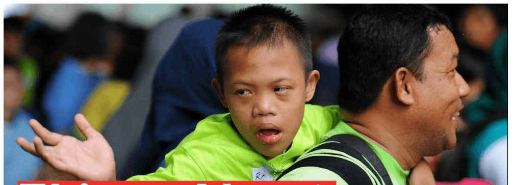 Down syndrome Down syndrome