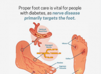 Here's How To Take Care Of Your Foot Health If You Have Diabetes