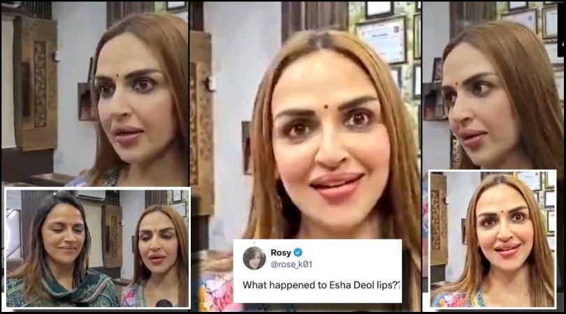 Esha Deol lip job Esha Deol lip job