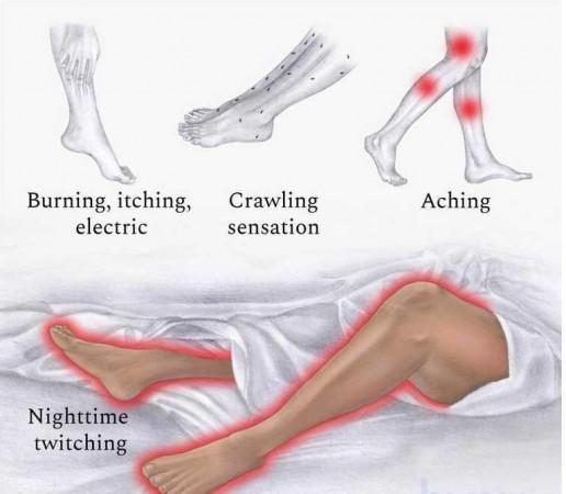 Scientists find hope to treat restless leg syndrome restless leg syndrome