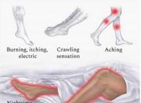 restless leg syndrome