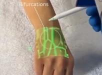 Anand Mahindra shares video of new tech detecting veins using infrared light