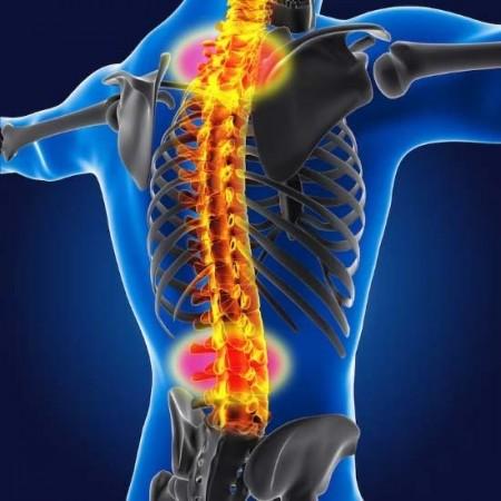 Spinal Muscular Atrophy