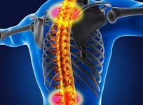 Spinal Muscular Atrophy