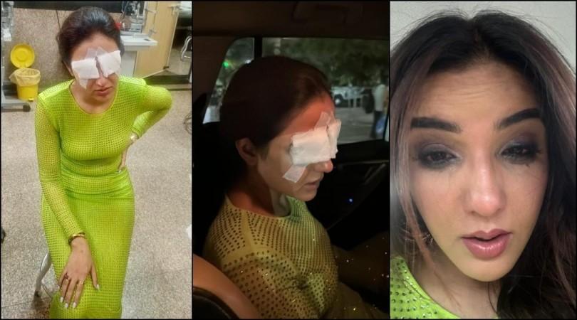 'I couldn't see properly after a while':Jasmin Bhasin suffers corneal damage; lens mishap leaves her in pain 'I couldn't see properly after a while':Jasmin Bhasin suffers corneal damage; lens mishap leaves her in pain