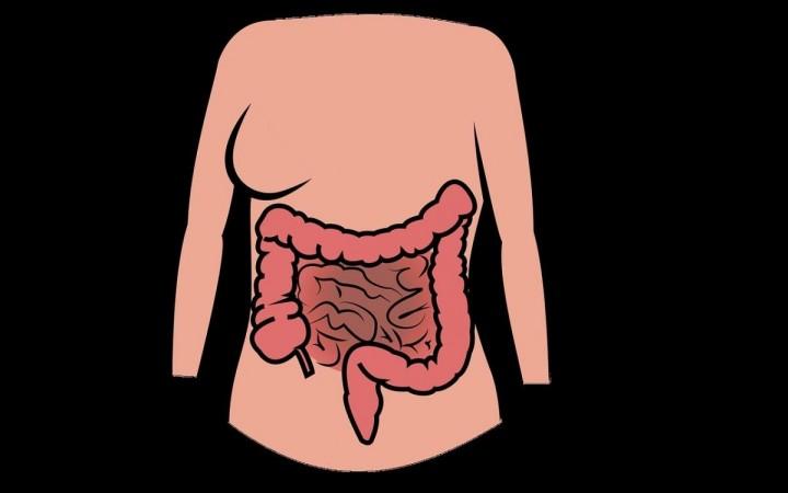 Late diagnosis of appendix cancer a concern Late diagnosis of appendix cancer a concern