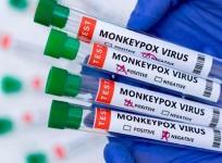 Congo receives first batch of mpox vaccines