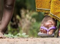 How India is fighting against lymphatic filariasis