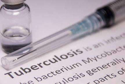 India accounts for 26 pc of global TB burden, the highest: WHO India accounts for 26 pc of global TB burden, the highest: WHO
