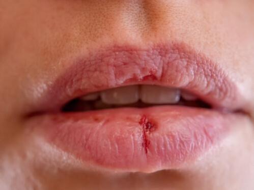 First-ever cell model developed to boost treatment for lip injuries