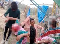 Girl's hair gets entangled in swing's rod in Uttar Pradesh; scalp ripped off