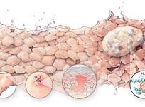 Australian-German research finds world-first cure for deadly skin disease