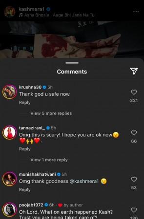 'Something worse…': Kashmera Shah meets with car accident in US; shares photos of blood-soaked cloth; Krushna Abhishek reacts 'Something worse…': Kashmera Shah meets with car accident in US; shares photos of blood-soaked cloth; Krushna Abhishek reacts