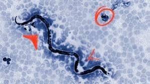 Ivermectin tablets are used to treat various parasitic infections that can affect the intestinal tract, skin, and eyes Ivermectin tablets are used to treat various parasitic infections that can affect the intestinal tract, skin, and eyes