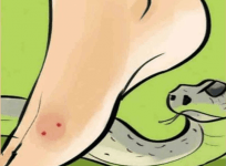 Centre declares snakebites a notifiable disease in India