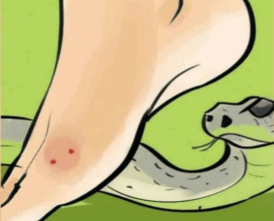 Centre declares snakebites a notifiable disease in India
