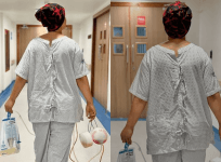 Hina Khan cancer treatment