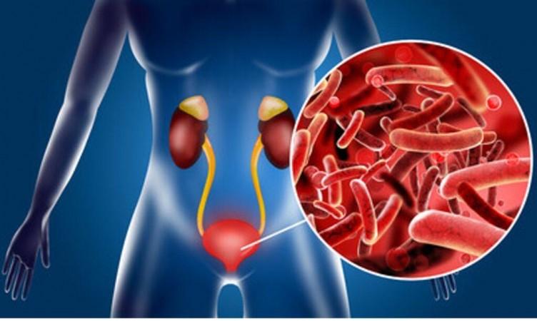 Collaboration will focus on identifying potential markers for recurrent urinary tract infections (rUTI) Collaboration will focus on identifying potential markers for recurrent urinary tract infections (rUTI)