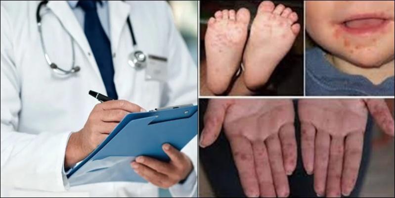 Global prevalence of atopic dermatitis to reach 42.42 mn by 2033 Global prevalence of atopic dermatitis to reach 42.42 mn by 2033