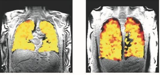 Scientists develop scan that unravels secrets of lung function Scientists develop scan that unravels secrets of lung function