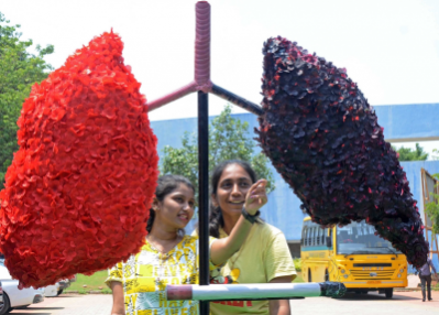 Women more likely than men to live for 5 years after lung transplant: Study Women more likely than men to live for 5 years after lung transplant: Study