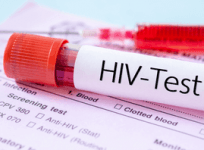 Global diagnosed HIV prevalence to reach over 2.2 mn in 2033: Report