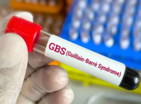 Guillain-Barre Syndrome (GBS)