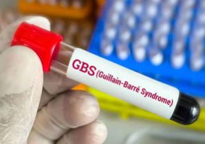 Guillain-Barre Syndrome (GBS)