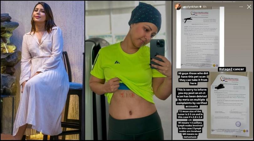 Stage 2 triple-negative breast cancer, not Stage 3': Rozlyn Khan Shares Hina Khan's PET Scan Reports, Claims She Misled Fans About Diagnosis; Hina Khan Responds Stage 2 triple-negative breast cancer, not Stage 3': Rozlyn Khan Shares Hina Khan's PET Scan Reports, Claims She Misled Fans About Diagnosis; Hina Khan Responds
