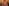 'Looks Old, Glow is Gone': Disha Vakani looks unrecognisable as she makes first public appearance in 8 Years after leaving TMKOC; fans shocked  [Then & Now Pics]